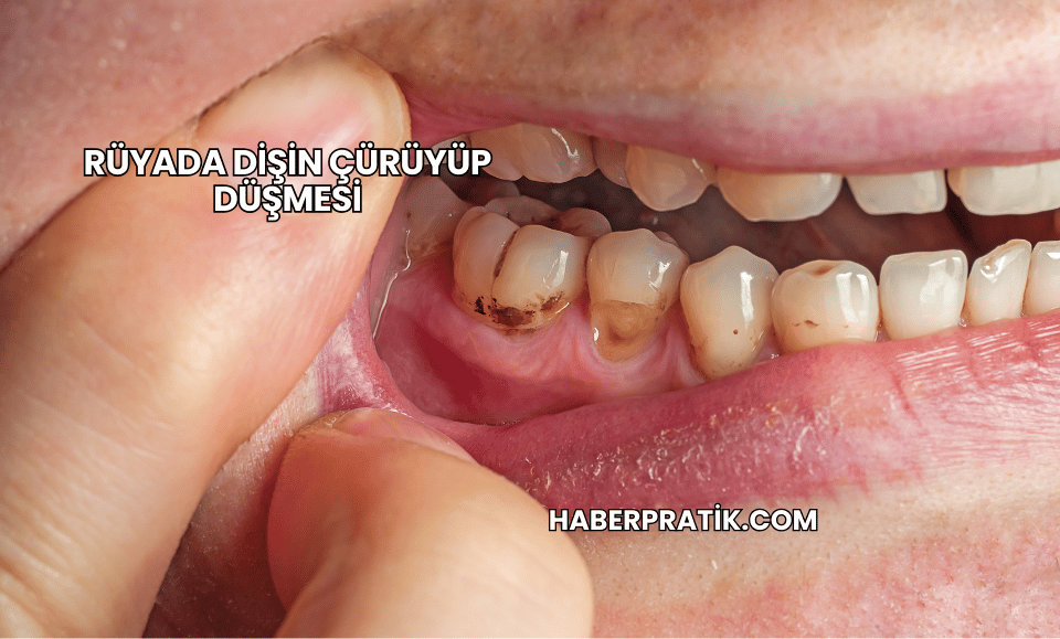 Rüyada Dişin Çürüyüp Düşmesi